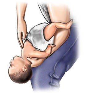 Stappen om verstikking baby's (4-5) bron: www.webmd.com