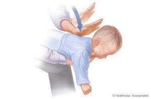 Stappen om verstikking baby's (1-3) bronnen te helpen: www.webmd.com