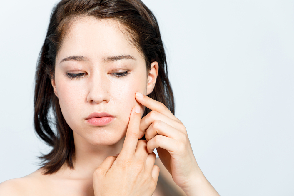 slecht haar vuile gewoonten veroorzaken acne