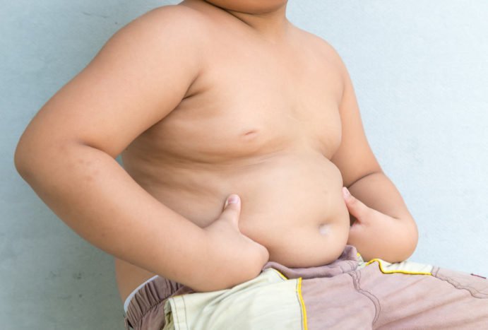 obesitas bij kinderen