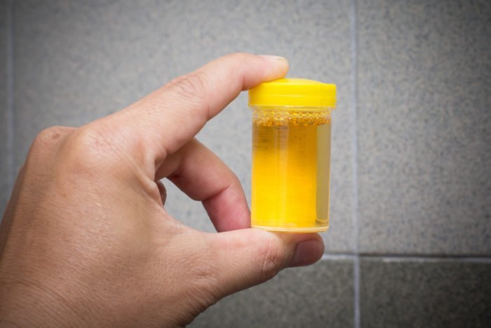 urinetherapie om urine te drinken