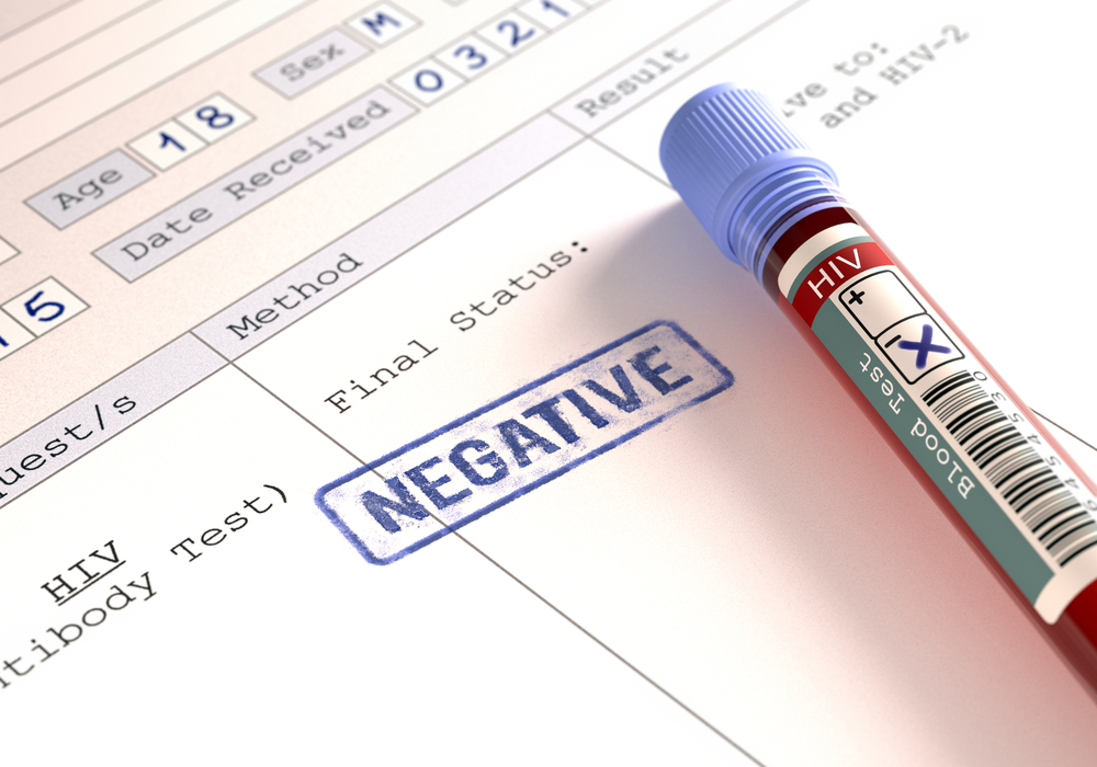 de betekenis van de resultaten van een negatieve HIV-test