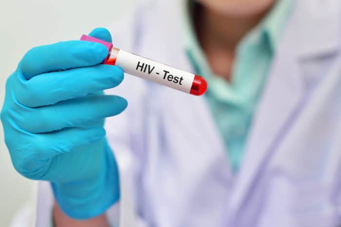 HIV-bloedtest